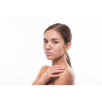 Lighten Brown Hair Shampoo | Camomila Intea® Blond Highlights Shampoo – Intea Cosmetics